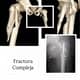 Slider image (10) Dr. Rodrigo Aguirre Rojas Orthopedic Surgeon in Mexico